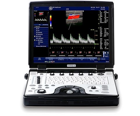 EcoColorDoppler